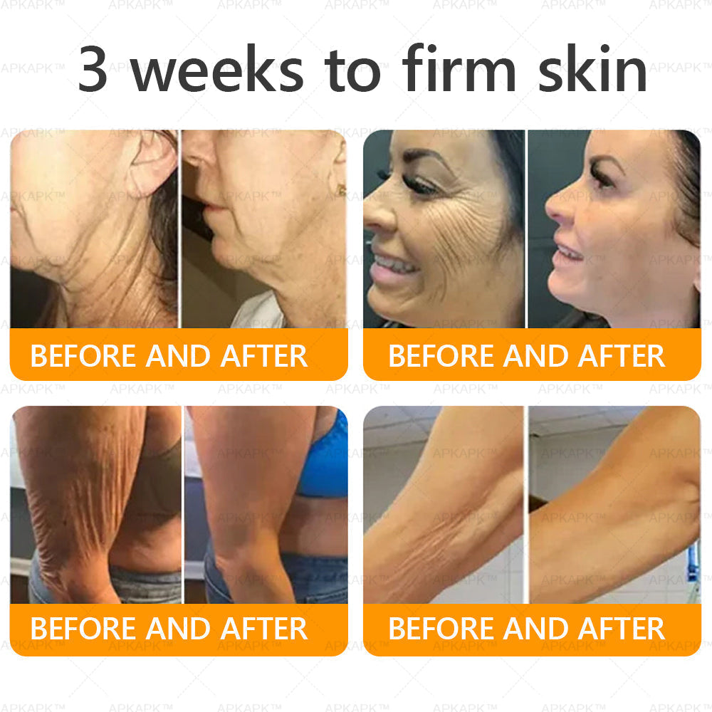 Made and Shipped from CA✨ APKAPK® Bee Venom Skin Restoration Cream🔥 LAST DAY 80% OFF 💎💎 Powerful anti-aging solution that targets deep wrinkles, fine lines, sagging skin, uneven tone, and dryness