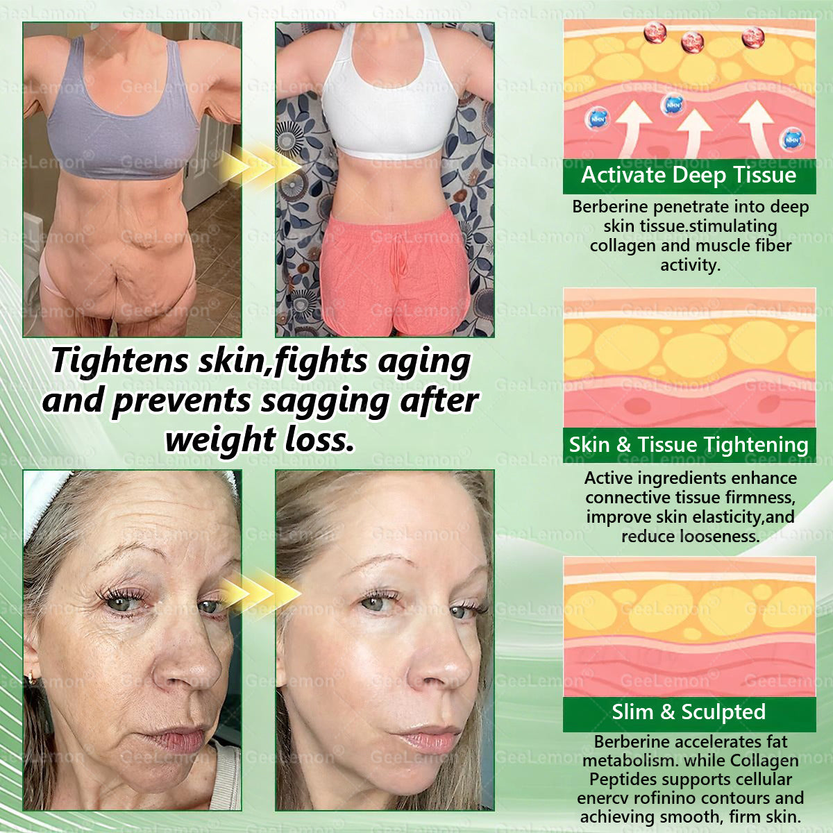 𝐆𝐞𝐞𝐋𝐞𝐦𝐨𝐧® 𝐌𝐨𝐫𝐢𝗻𝗴𝗮 · 𝐁𝐞𝐫𝐛𝗲𝗿𝗶𝗻𝗲 × 𝗡𝗔𝗗+ 𝟏𝟎 𝐢𝐧 𝟏 𝐀𝐝𝐯𝐚𝐧𝐜𝐞𝐝 𝗡𝗮𝗻𝗼 𝗠𝗶𝗰𝗿𝗼𝗻𝐞𝐞𝐝𝐥𝐞 𝐏𝐚𝐭𝗰𝗵(Just once a day, visible changes in 7 days) For obesity, cardiovascular health, diabetes, sleep apnea, thyroid gland, intestinal health, joint problems and more